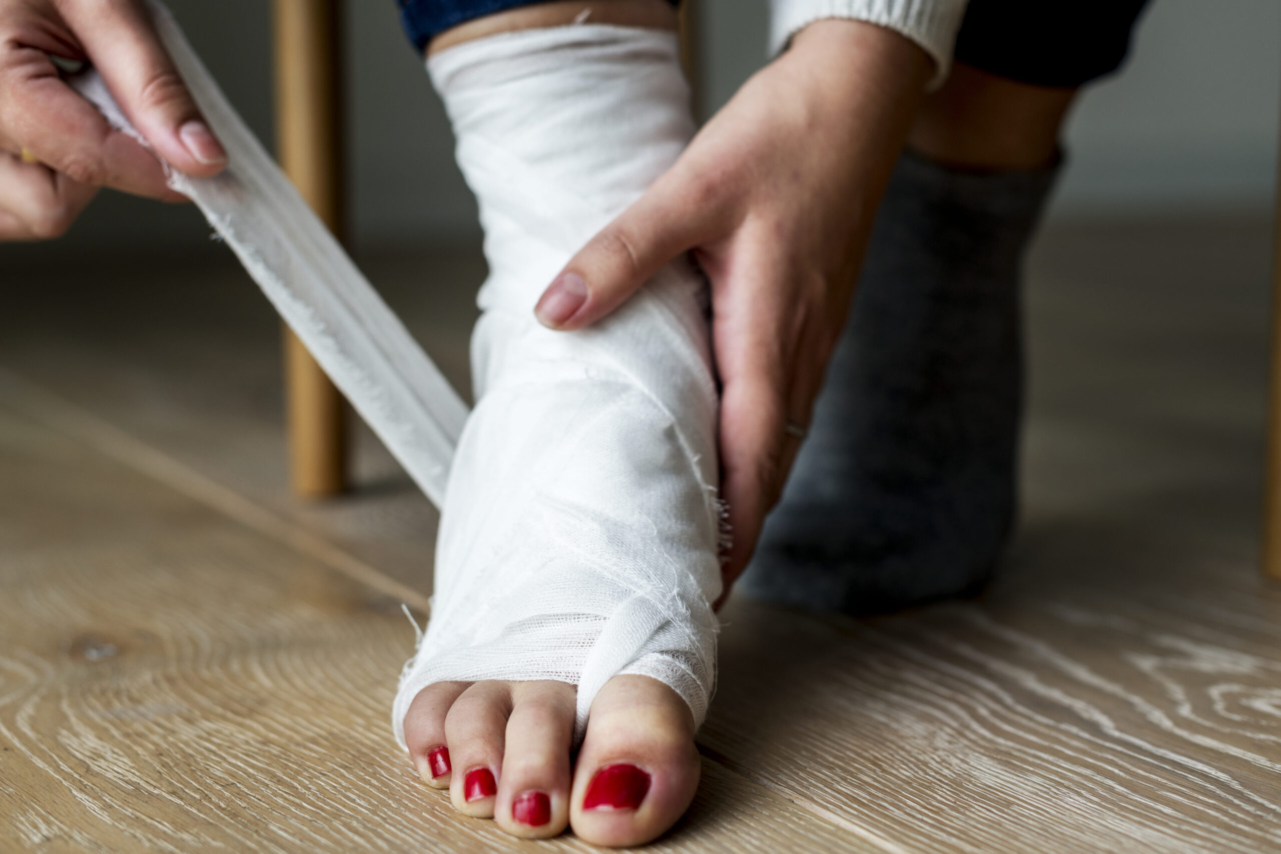 Challenges of a Slip and Fall Case